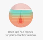 Handheld Sapphire  Cooling IPL Hair Removal - 图片 2