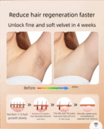 Freezing point depilatory apparatus - 图片 3