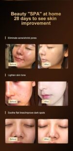 Large panel LED beauty device-E80 - 图片 4