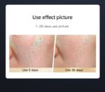 Collagen cosmetology instrument for small row lamp - 图片 6