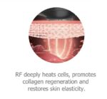 4 in 1 Fat Lose  Body Slimming Device - 图片 4