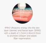 High-precision ultrasonic beauty king (new product) - 图片 5