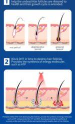 Germinal cap - 图片 5