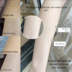 IPL Ice Aphailometer - 图片 2